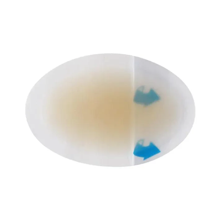 Medical Hydrocolloid Dressing Hydrogel Wound Dressing with Thin Border