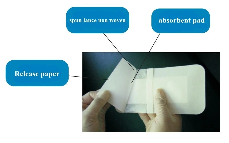 Hospital Transparent Foam Silicone Wound Dressing Manufacturer with CE ISO Supply