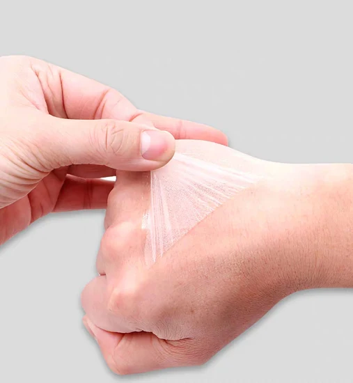 Disposables IV Transparent Dressing for Cover and Protect The Wound After Operation, Emergency Wound, Minor Cut and Brush Burn, Fix Catheter Needle